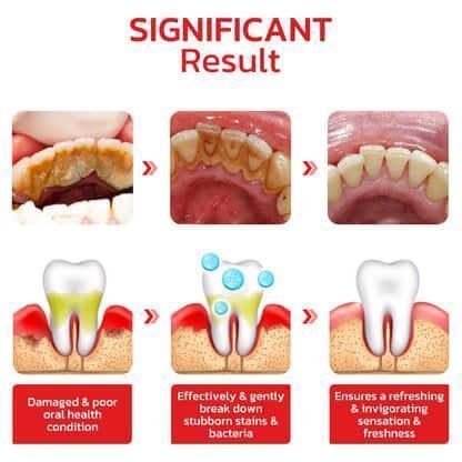 𝗢𝗿𝗶𝗴𝗻𝗮𝗹™ 𝗦𝗣𝟰 𝗨𝗹𝘁𝗿𝗮 𝗧𝗲𝗲𝘁𝗵 𝗪𝗵𝗶𝘁𝗲𝗻𝗶𝗻𝗴 𝗧𝗼𝗼𝘁𝗽𝗮𝘀𝘁𝗲 - Trendsters Pk