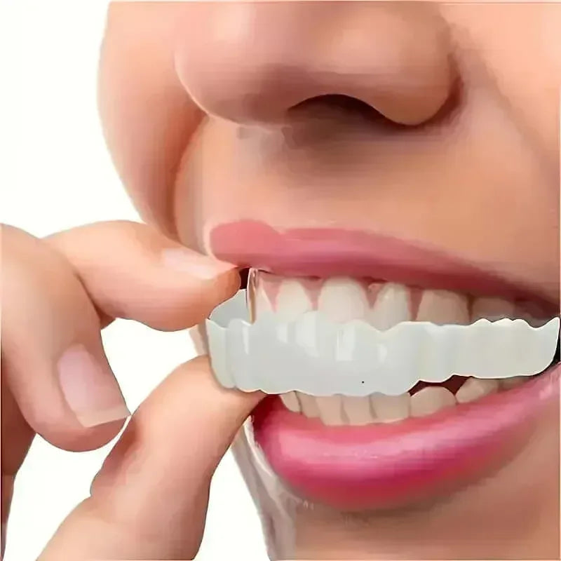 Realistic Dental Veeners - Upper & Lower Teeth, Natural Look & Whitening - Trendsters Pk