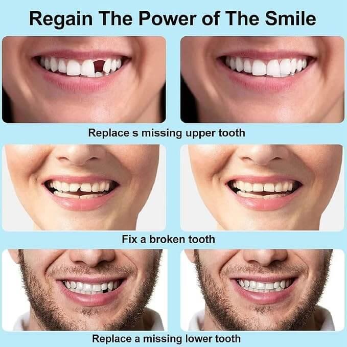 Orignal™ Moldable False Teeth - Trendsters Pk