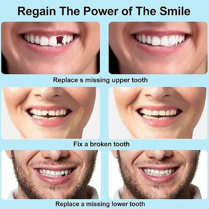 Orignal™ Moldable False Teeth - Trendsters Pk